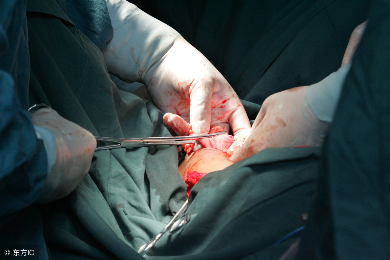 湿疣和尖锐疣有什么区别,尖锐性湿疣跟疣的区别