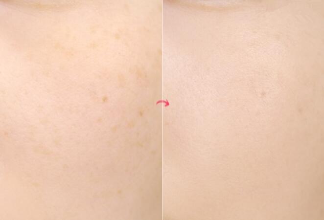 雅诗兰黛沁水粉底液夏天适合用吗,雅诗兰黛粉底液适合秋冬天吗