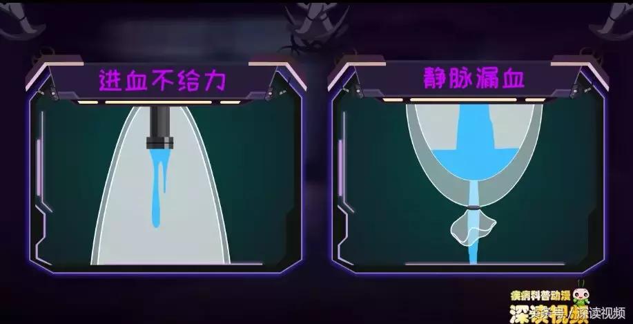 谁让你“兄弟”不给力，谁让你“痿”靡不振？阳痿诱发因素知多少