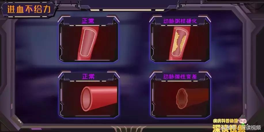 谁让你“兄弟”不给力，谁让你“痿”靡不振？阳痿诱发因素知多少