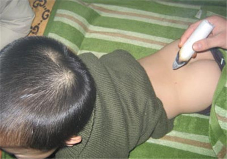 小孩可以做艾灸吗,小孩艾灸的好处与功效