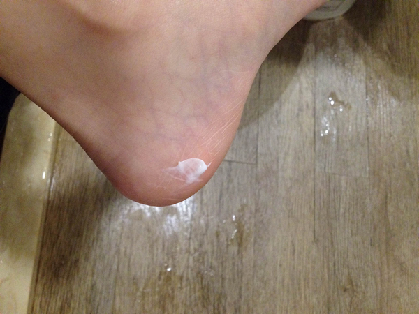 怎样泡脚能去脚上的干皮,泡脚有没有改善皮肤干燥