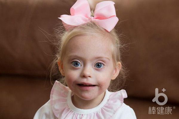 唐氏儿童长大后没有生育能力吗,唐氏综合征的孩子有生育能力吗