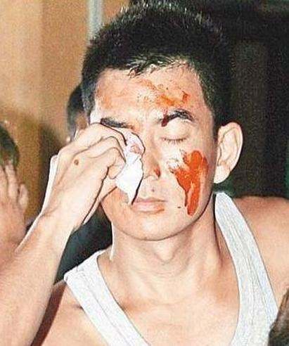 盘点明星拍戏时突发意外,盘点明星发生的意外事件