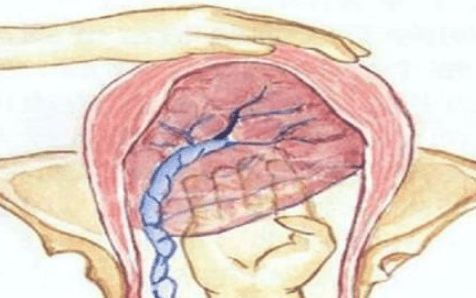 分娩遇到的尴尬事,分娩中的尴尬事都有哪些