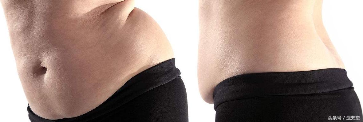 如何将便秘“连根拔起”？这些材料冲茶喝，肠道通了，肚腩也消了