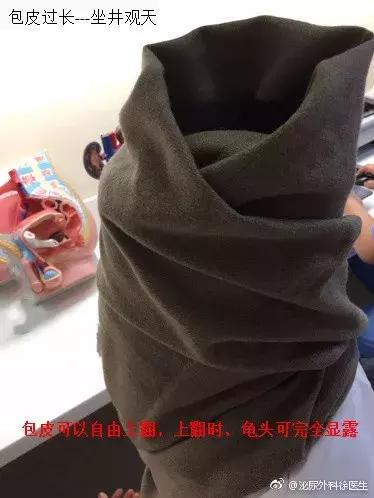 怎么判断自己的包皮需不需要割,如何判断包皮到底需不需要割