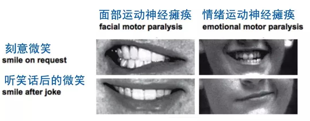 心理学家告诉你：假笑究竟是怎么一回事？