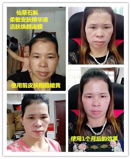 石斛仙草蚕丝面膜,仙草石斛焕颜活肤面膜