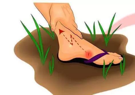 破伤风的伤口分类和处理,可能引起破伤风的伤口多久会好