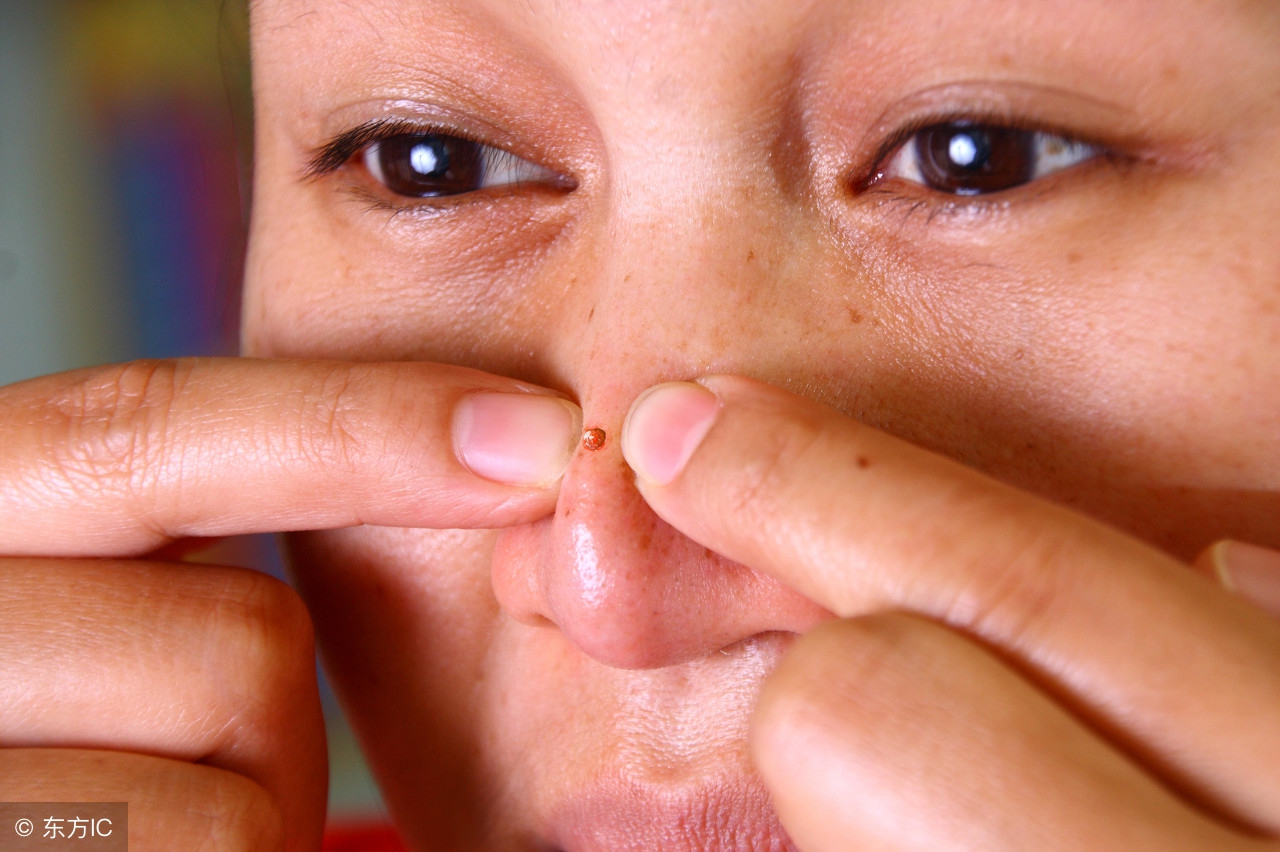 鼻干鼻痒打喷嚏鼻腔用什么药,鼻干鼻痒打喷嚏鼻腔壁出血缓解