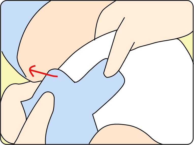 这样帮宝宝更换纸尿裤，告别漏屎漏尿和红痕