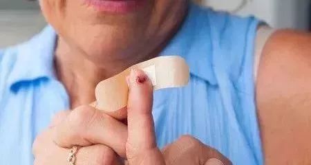 创可贴贴伤口上撕不下来太疼,创可贴适合大面积伤口吗