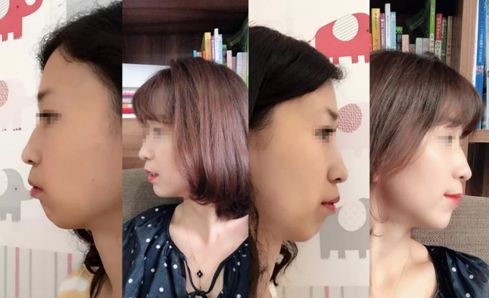 速看！刚刚发布大消息！8月起牙齿矫正、种植牙这10项费用全免！