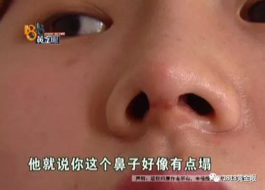 老总嫌她鼻子不好看，说贴钱让她去整下……后面的问号越来越多