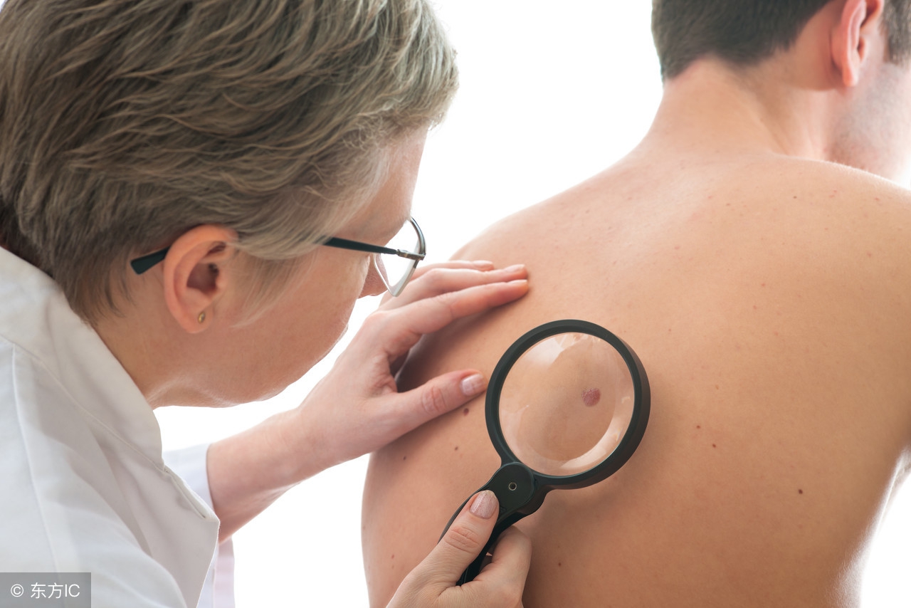 脸上有一颗痣很大怎么去除,脸上有痣看一下代表什么