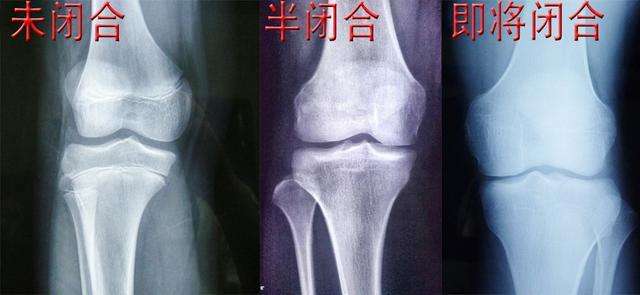 20岁身高160男生还可以长高吗,25岁还能继续长高吗