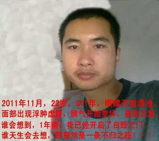 手淫3年，面貌早衰——戒手淫2年后改变！