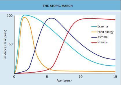 孩子湿疹最佳图片,孩子面部湿疹