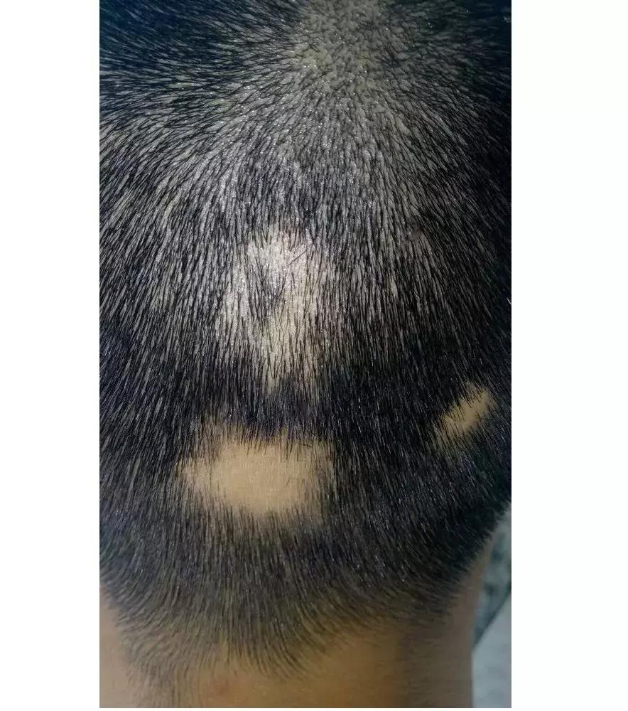 小伙戒赌2年,小伙戒烟一年后