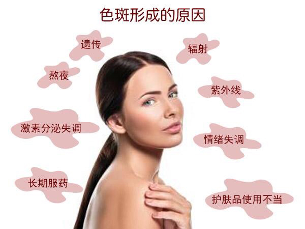 最近才长的色斑该怎么去,想要摆脱色斑一个小办法教你