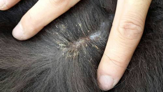 人体的虱子是怎么长出来的,成年后虱子是还会有吗