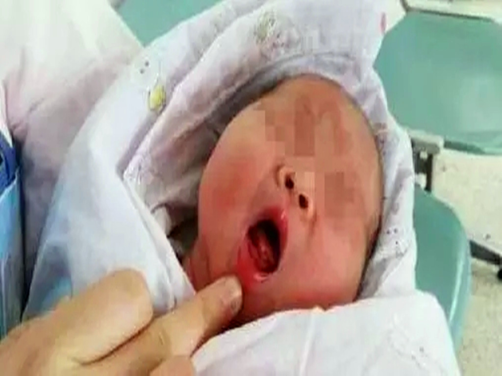 1岁宝宝口腔溃疡,1岁宝宝口腔溃疡原因