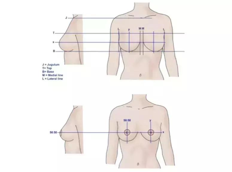 美沃斯早参0817｜最美乳头乳晕位置比例;O2O平台与百度营销对比
