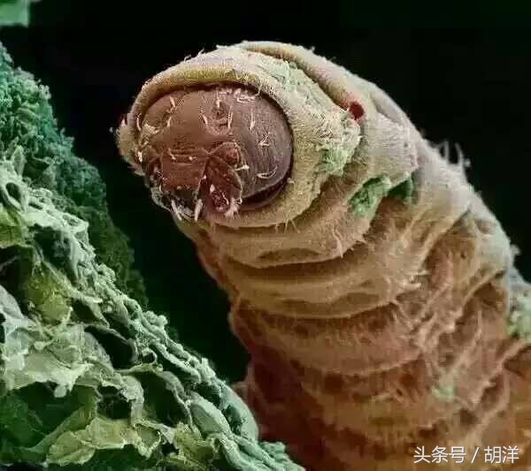 妇科真菌感染的克星,厌氧菌感染妇科怎么治疗