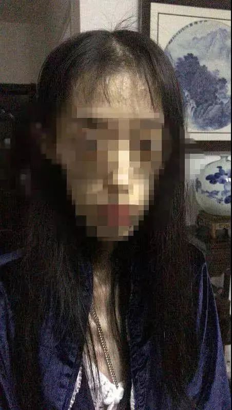 「健康」21岁女孩自杀式减肥只剩50斤，照片不忍直视