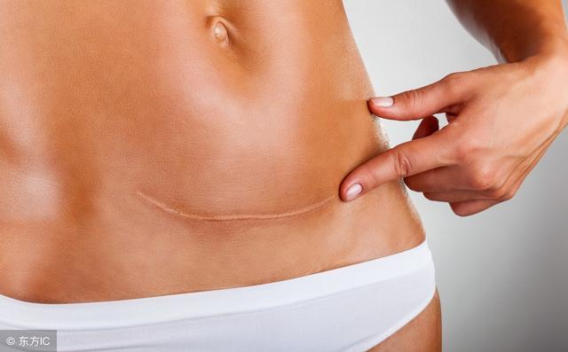 宫颈囊肿要注意哪些事项呢,怎么预防宫颈囊肿