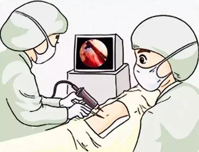 膝关节有轻微卡住的感觉怎么办,膝关节像被卡住疼痛怎么办