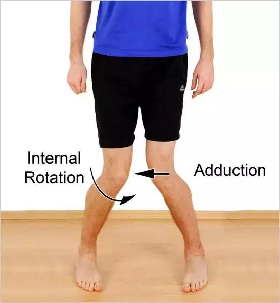 跑者”专利”:一文看懂膝外侧疼痛如何解决