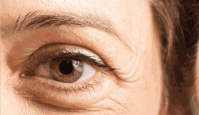 濡備綍鎷ユ湁鐑反鐨勫ぇ鐪肩潧,鐑反鐪肩潧閫犲瀷