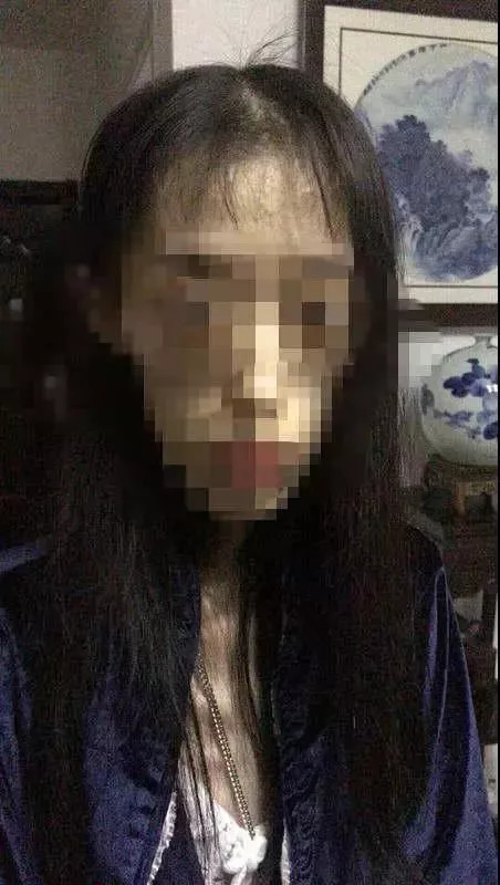 如此减肥？不忍直视！21岁女孩自杀式减肥只剩50斤