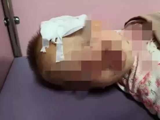 女婴遭狗扑咬完整视频,女婴遭140斤恶犬撕咬面部20分钟