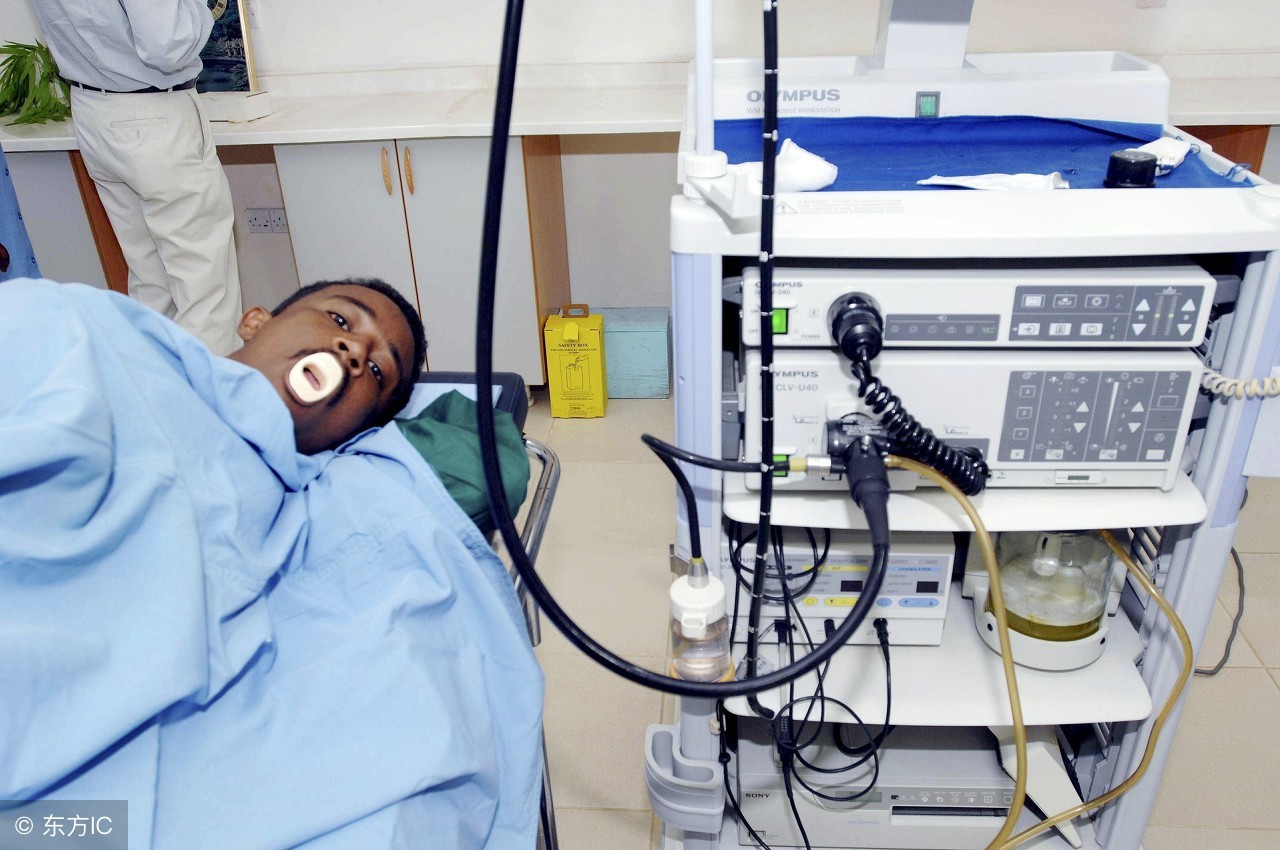 无痛胃镜和普通胃镜如何选择,普通胃镜和无痛胃镜如何选择