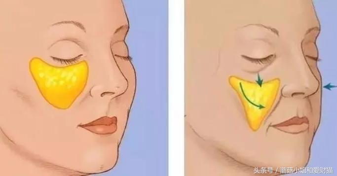 脸大面部凹陷的人好显老,脸上好多凹陷怎么回事