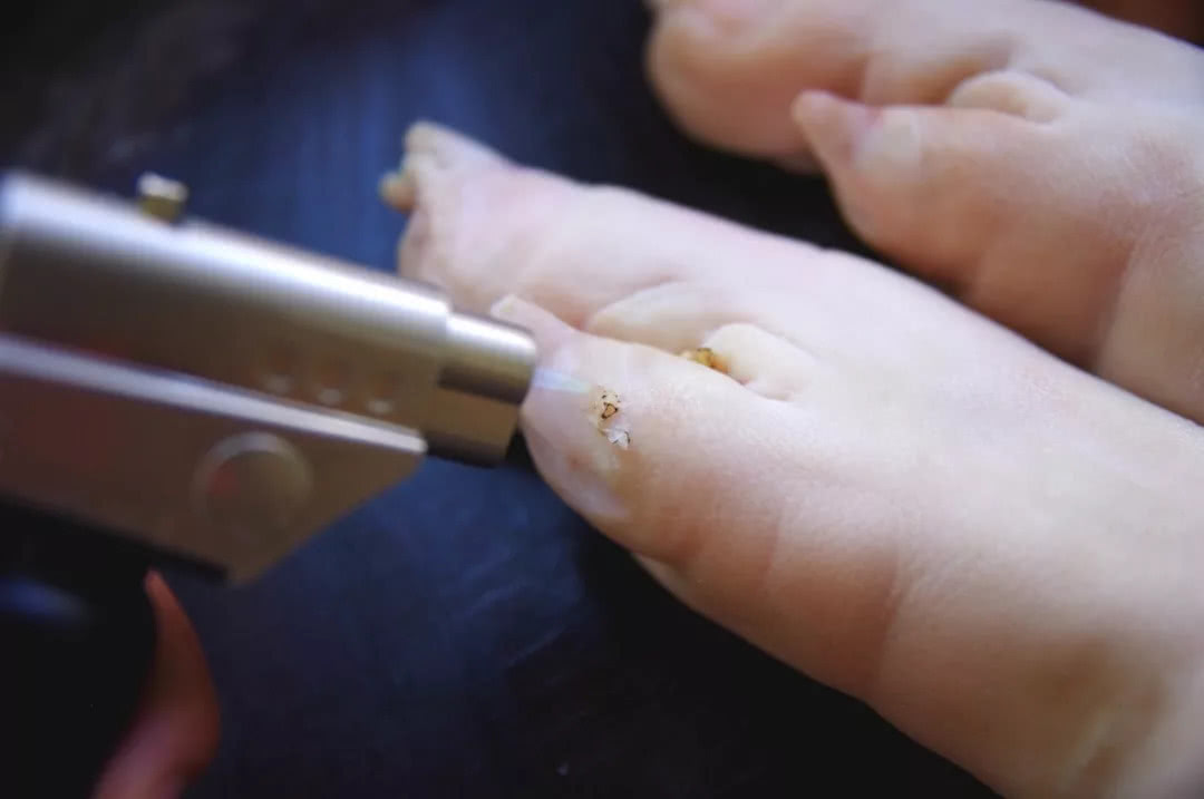 我们家的大猪蹄子，先烧再炖后烤，软而不烂，吃起来解恨又解馋！