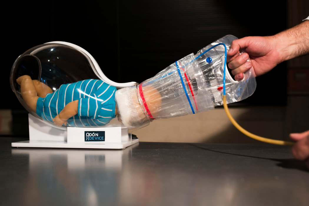 葡萄酒瓶里的软木塞给他灵感，汽车修理工发明出了生孩子的工具