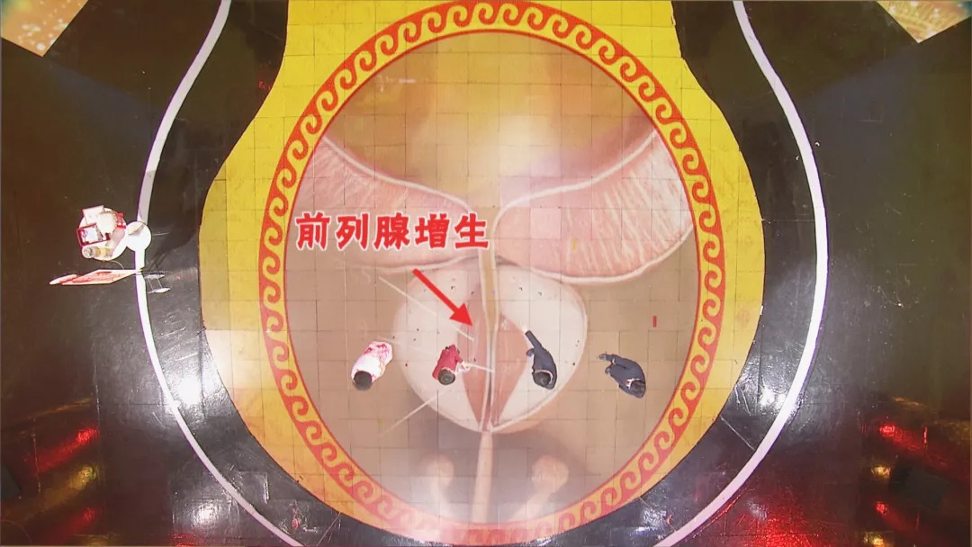 养生堂最新节目完整版,养生堂今天节目