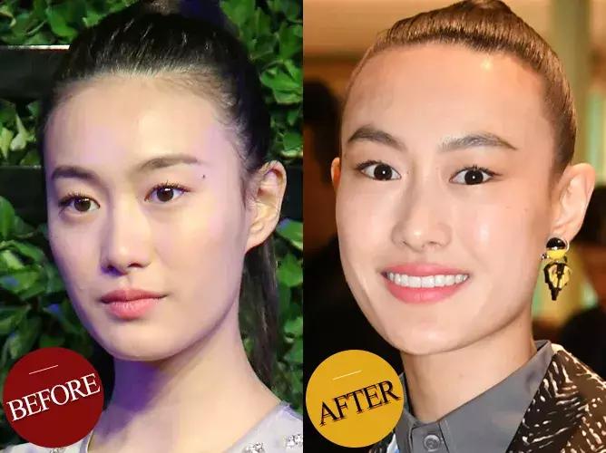 防脱发女生,防脱发明星代言哪个好