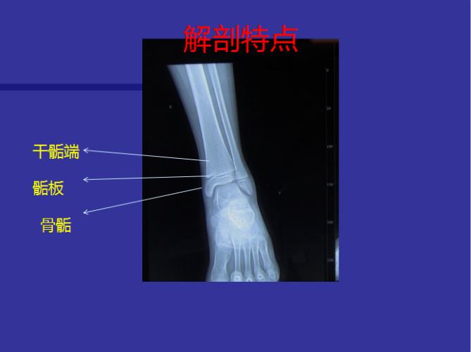 骨骺损伤手术修复后能恢复正常吗,儿童骨骺损伤手法复位