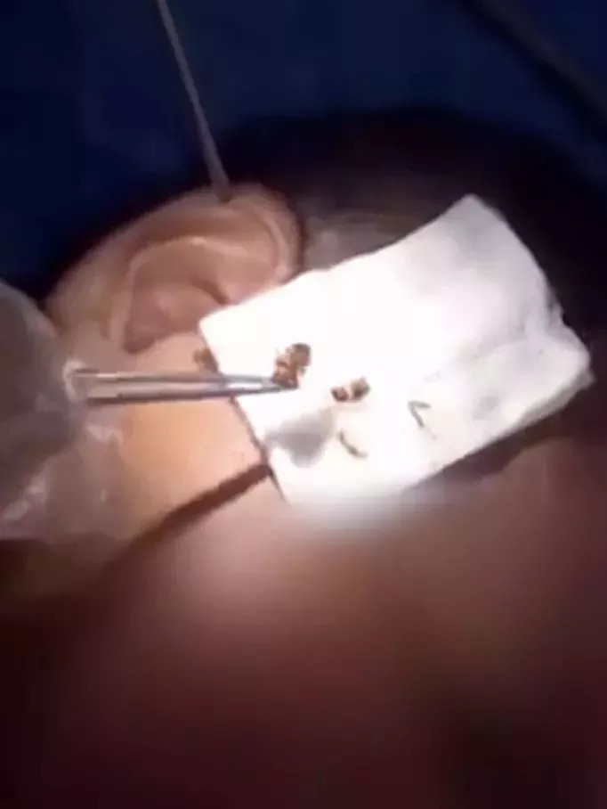 女子发烧40度罪魁祸首,女孩发烧7天后不治身亡