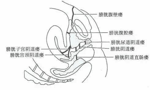 异常通道出现？年轻辣妈的烦心事儿