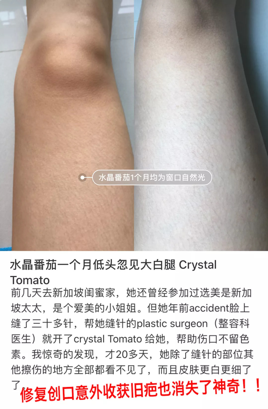 坚持7天的细纹消失,没有细纹但是有斑点