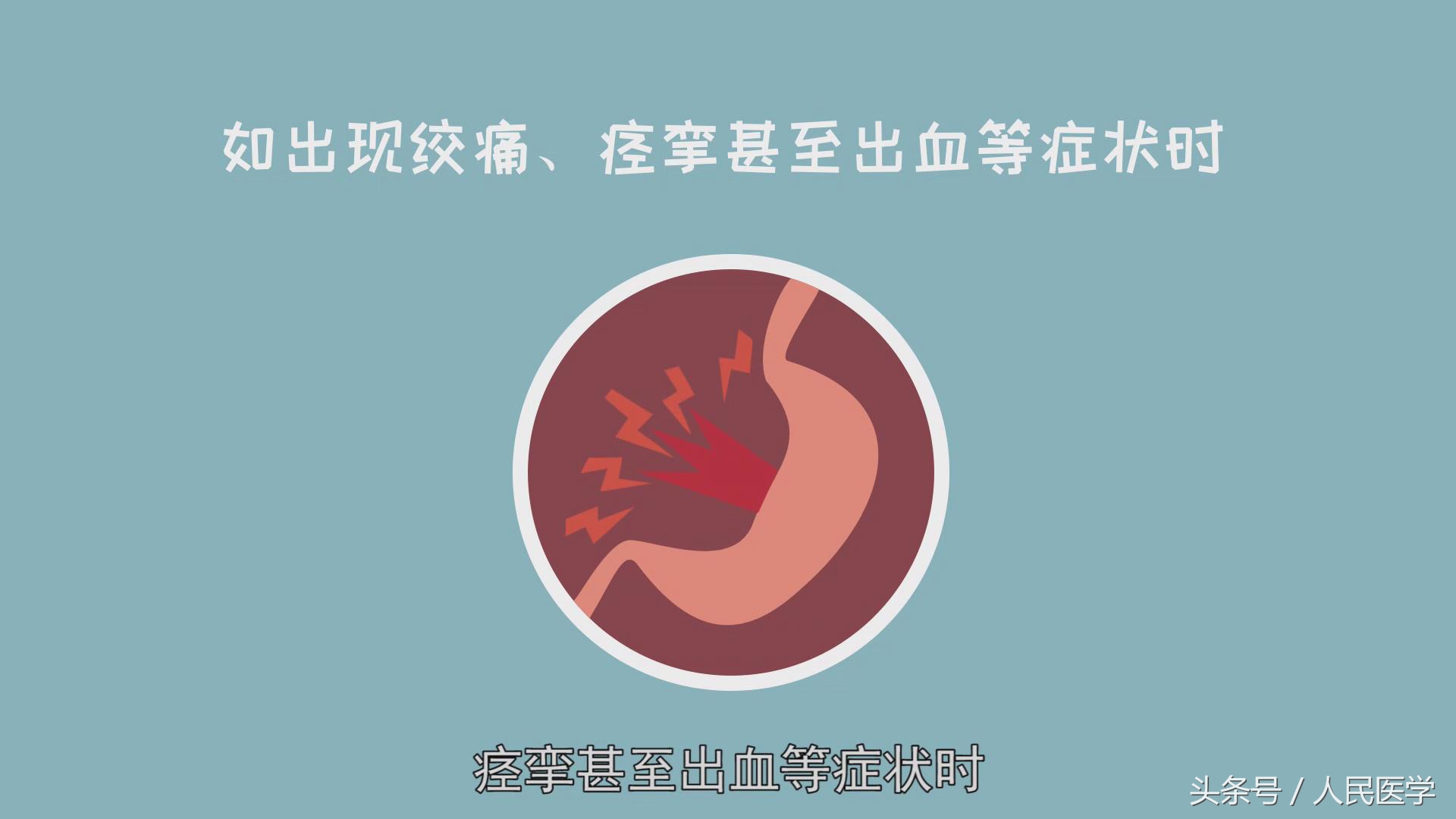 达喜可以治疗胃难受吗,胃不舒服一吃达喜就好了