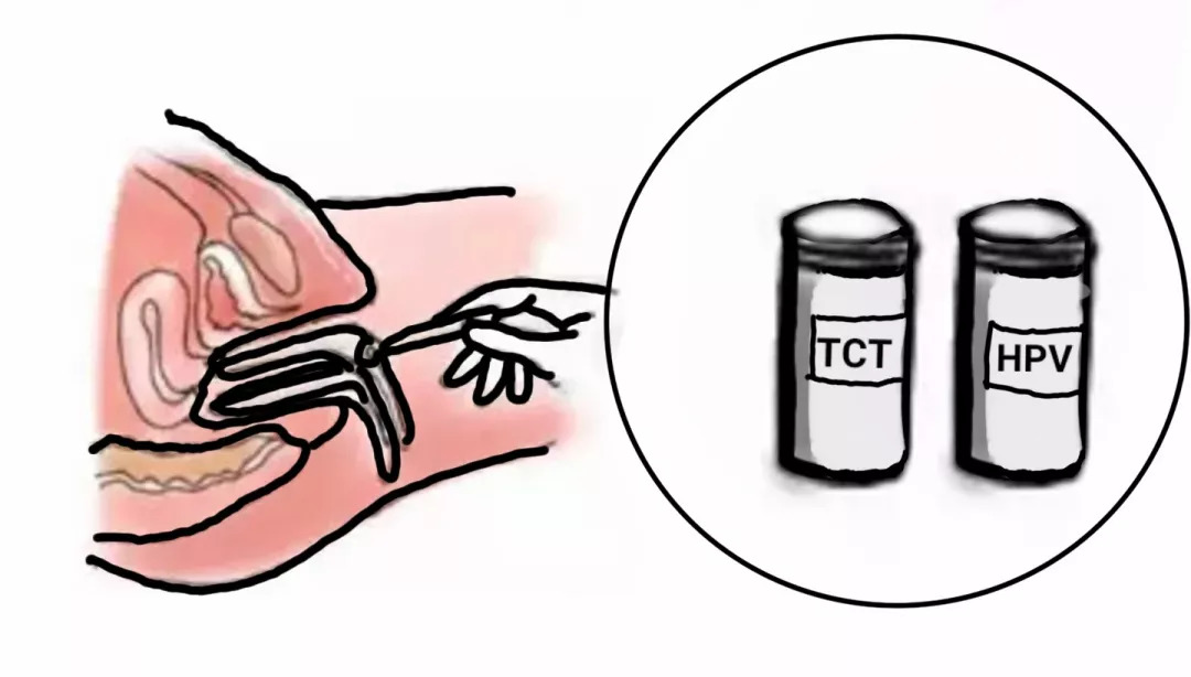 女性宫颈糜烂有什么症状和现象,宫颈糜烂用什么药好得快效果好