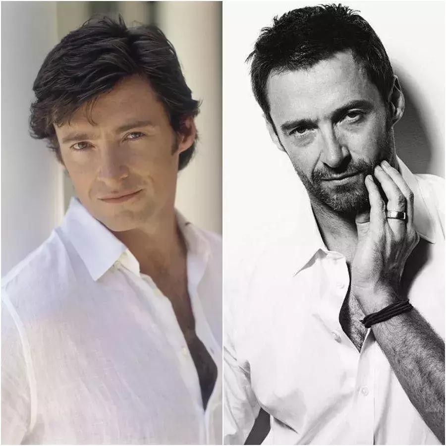 除了发量,最暴露年龄的可能是这两道纹