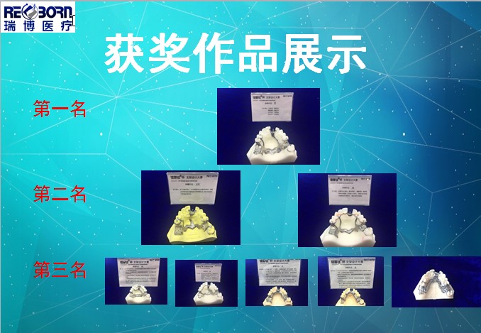 涔夐娇3d鎵撳嵃鏀灦,3d鎵撳嵃涔夐娇鏀灦瑙嗛